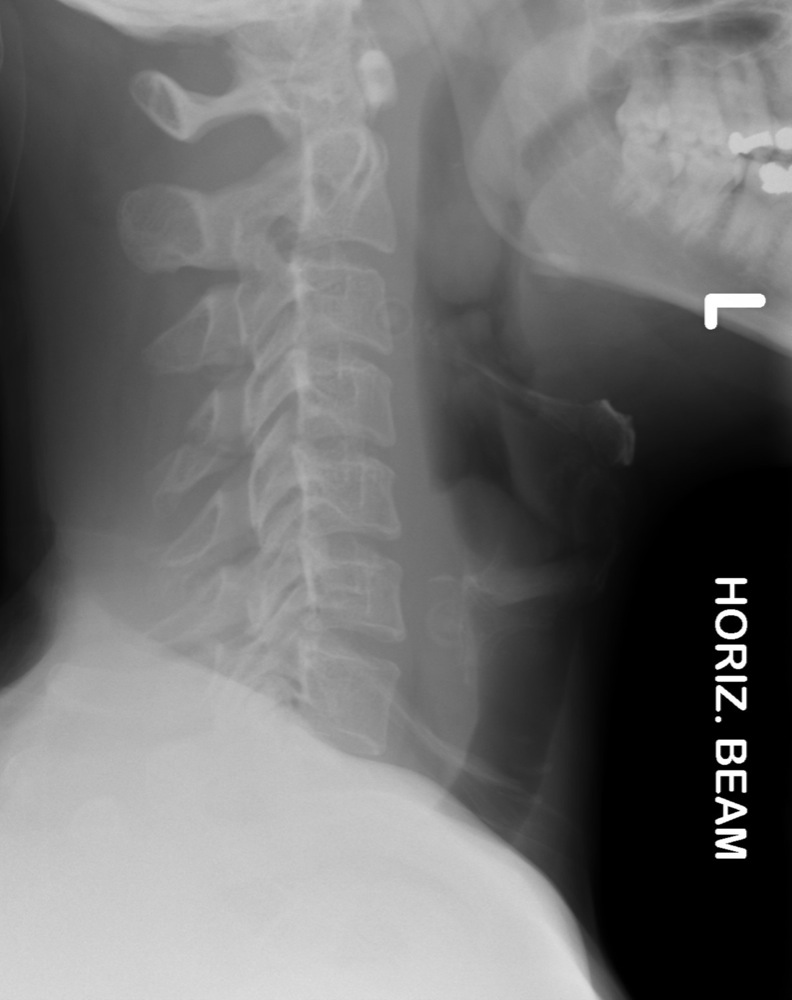 The Cervical Spine